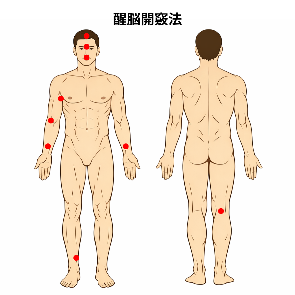 醒脳開竅法の経穴イラスト